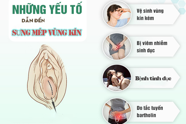 Điểm qua nguyên nhân gây sưng mép vùng kín