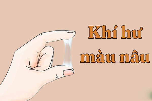 Khí hư màu nâu bệnh lý nếu không điều trị sẽ gây biến tác hại xấu