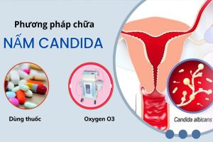 Nấm Candida: Nguyên nhân, triệu chứng và cách khắc phục hiệu quả