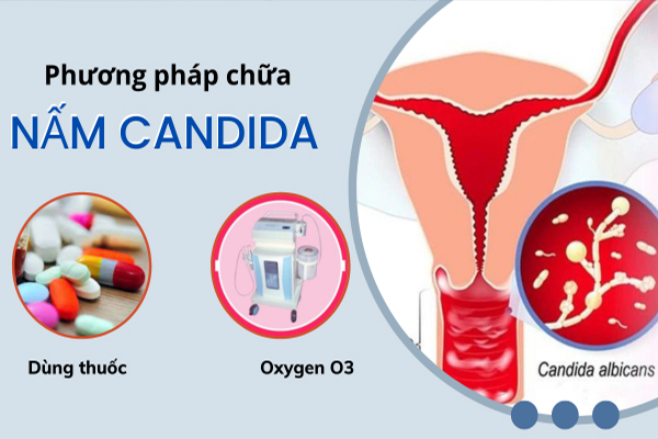 Điều trị nấm Candida hiệu quả tại Phòng Khám Trường Hải