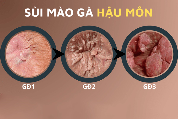 Xac-dinh-hinh-anh-sui-mao-ga-o-cac-vi-tri-tren-co-the-2