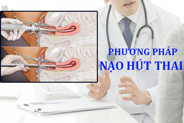 Phương pháp nạo hút thai an toàn