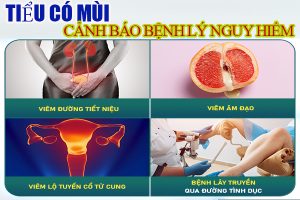 4 nguyên nhân khiến nước tiểu có mùi – Dấu hiệu đáng lo ngại