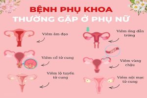 Bệnh phụ khoa là gì? Dấu hiệu bệnh phụ khoa thường gặp