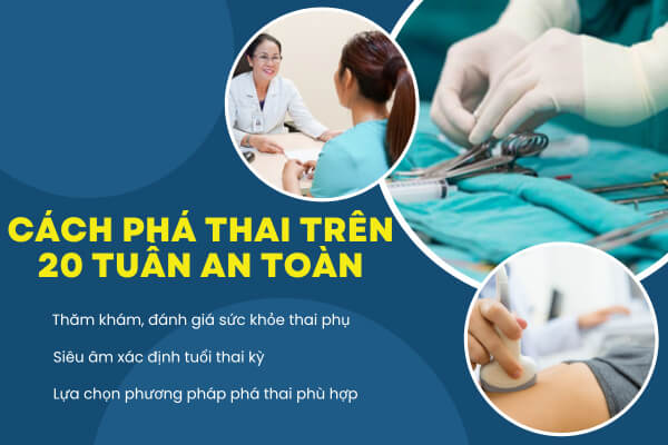 Cách phá thai trên 20 tuần an toàn