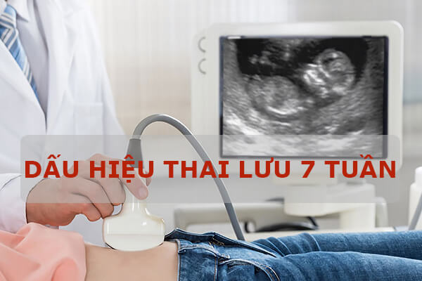 Dấu hiệu thai lưu 7 tuần