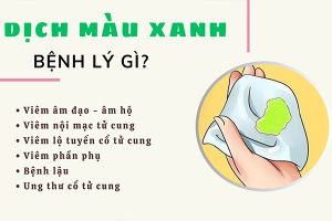 Dịch màu xanh – Dấu hiệu bệnh phụ khoa nguy hiểm