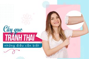 Lý do chị em nên chọn cấy que tránh thai?