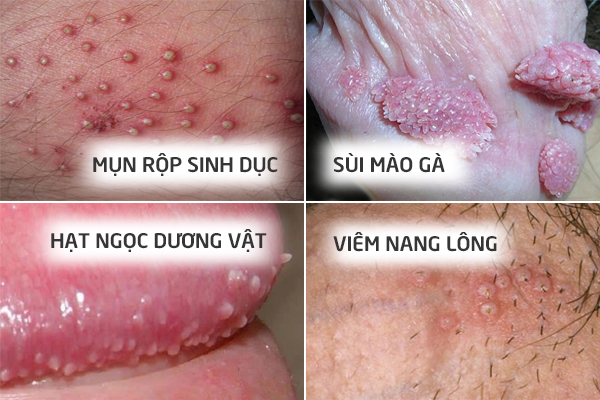 noi-mun-o-duong-vat