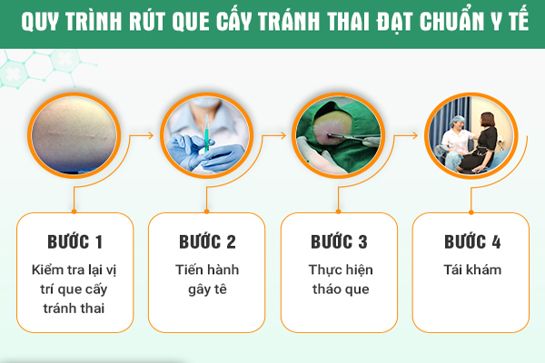 Quy trình tháo que tránh thai an toàn tại Phòng Khám Trường Hải