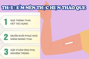 Tháo que tránh thai: Quy trình và những điều cần biết