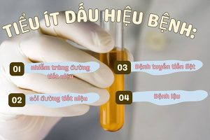 Tiểu ít ở nữ giới: Dấu hiệu, nguyên nhân và cách chữa