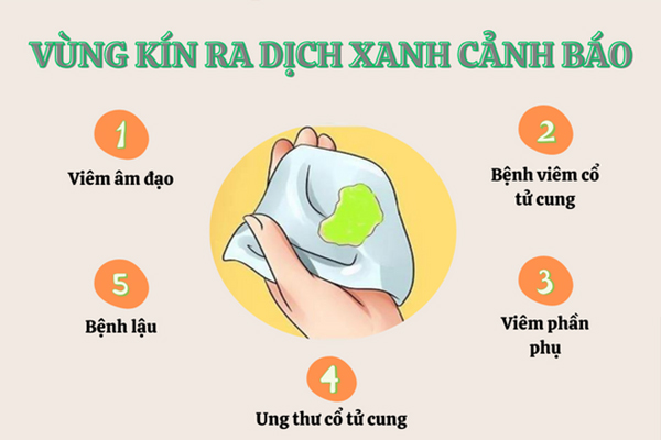 Vùng kín ra dịch xanh cảnh báo điều gì?