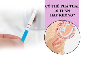 Phá thai 10 tuần tuổi có nguy hiểm không? Cơ sở phá thai an toàn