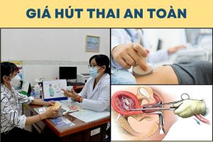 Giá hút thai an toàn có tốn kém không?