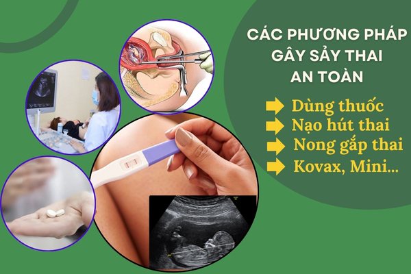 Các phương pháp gây sảy thai an toàn được áp dụng hiện nay