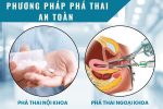 Các phương pháp bỏ thai an toàn