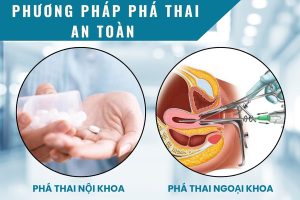 Muốn phá thai – Lựa chọn địa chỉ phá thai uy tín