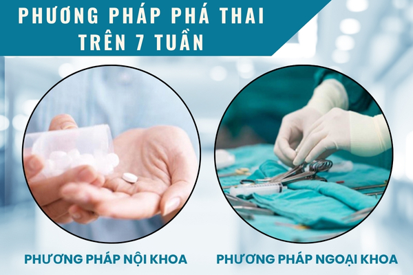 Các phương pháp phá thai trên 7 tuần