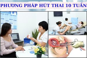 Hút thai 10 tuần có đau không? Địa chỉ bỏ thai lớn an toàn