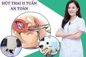 Hút thai 11 tuần có thực hiện được không? Địa chỉ bỏ thai lớn an toàn