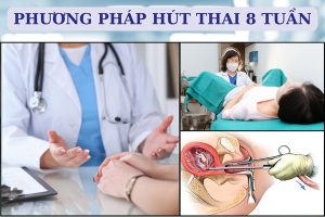 Địa chỉ hút thai 8 tuần ở đâu? Quy trình thực hiện như thế nào?