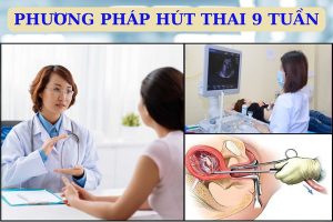 Hút thai 9 tuần có đau không? Địa chỉ đình chỉ thai ở đâu?