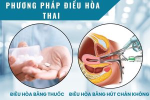 Phương pháp điều hòa thai an toàn – tiết kiệm – hiệu quả