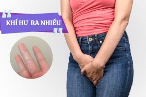 Khí hư ra nhiều – Dấu hiệu chị em cần lưu ý